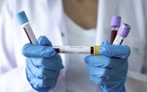 Новини Києва - У Києві зменшилася кількість хворих на COVID-19