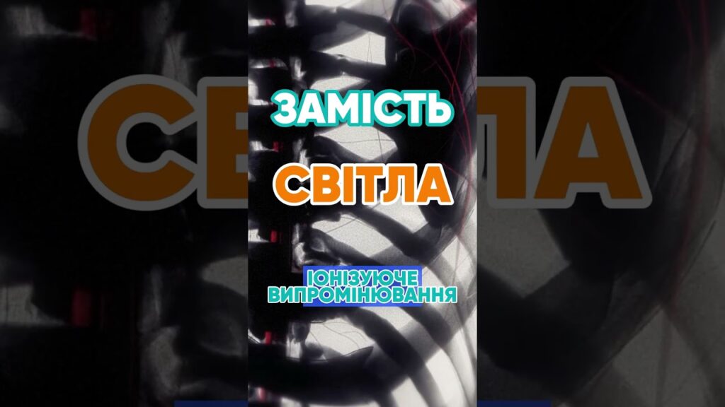 Чому рентген показує кістки? 🦴 #наука #цікаво #рентген #медицина